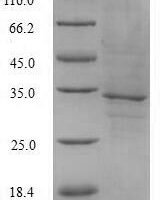 Human Fms-related tyrosine kinase 3 ligand (FLT3LG), partial Recombinant Protein - BioCrest Sci