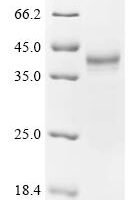 Anguilla japonica Ventricular natriuretic peptide (vnp) Recombinant Protein, C-hFc1 - BioCrest Sci