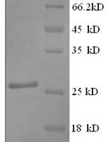 Rat Myosin-binding protein C, cardiac-type (Mybpc3), partial Recombinant Protein - BioCrest Sci
