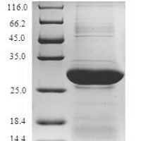 Mouse Glypican-4 (Gpc4), partial Recombinant Protein, N-GST, aa 530–557, E.coli - BioCrest Sci