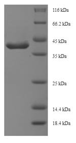 Bacillus subtilis L-cystine-binding protein tcyA (tcyA) Recombinant Protein, N-His-SUMO, Bacillus subtilis (strain 168), E.coli, N-terminal 6xHis-SUMO-tagged, 43.6 kDa, purity >≥ 90% as determined by SDS-PAGE.