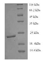 Mouse Ephrin-B3 (Efnb3), partial Recombinant Protein, N-His, aa 28–227, Yeast - BioCrest Sci