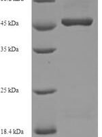 Human Oligodendrocyte transcription factor 2 (OLIG2) Recombinant Protein, N-His-SUMO - BioCrest Sci