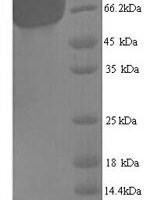Arabidopsis thaliana Trihelix transcription factor GT-1 (GT-1) Recombinant Protein, N-His, aa 1–406, Yeast - BioCrest Sci