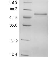 Human Suppressor of SWI4 1 homolog (PPAN) Recombinant Protein - BioCrest Sci
