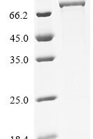 Mouse CTP synthase 1 (Ctps1) Recombinant Protein - BioCrest Sci
