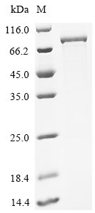 Mouse CTP synthase 1 (Ctps1) Recombinant Protein, Mus musculus (Mouse), E.coli, C-terminal 6xHis-tagged, 73.6 kDa, purity >≥ 85% as determined by SDS-PAGE.