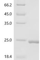 Pseudoalteromonas sp Lambda-carrageenase (cglA), partial Recombinant Protein - BioCrest Sci