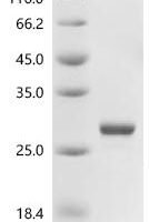 Human Putative BCoR-like protein 2 (BCORP1) Recombinant Protein - BioCrest Sci