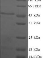 Human Estradiol 17-beta-dehydrogenase 11 (HSD17B11) Recombinant Protein - BioCrest Sci