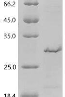 Human Insulin-like growth factor II (IGF2) (E30R, F43L, S63P) Recombinant Protein - BioCrest Sci