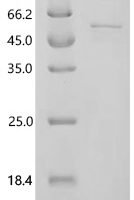 Mouse Acyl-protein thioesterase 1 (Lypla1) Recombinant Protein, C-GST - BioCrest Sci