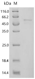 Mouse Acyl-protein thioesterase 1 (Lypla1) Recombinant Protein, C-GST, Mus musculus (Mouse), E.coli, C-terminal GST-tagged, 56.3 kDa, purity >≥ 85% as determined by SDS-PAGE.
