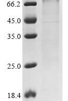 Mouse Mannan-binding lectin serine protease 2 (Masp2) Recombinant Protein, N-10His/C-Myc - BioCrest Sci