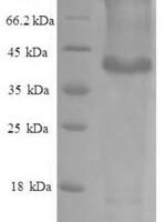 Human Protein phosphatase 1 regulatory subunit 11 (PPP1R11) Recombinant Protein - BioCrest Sci