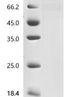 Human Poly [ADP-ribose] polymerase 1 (PARP1) Recombinant Protein, C-10His - BioCrest Sci
