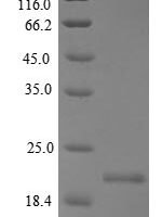 Mouse Allergin-1 (Milr1), partial Recombinant Protein - BioCrest Sci