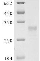 Cat Trefoil factor 3 (TFF3) Recombinant Protein - BioCrest Sci