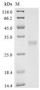 Cat Trefoil factor 3 (TFF3) Recombinant Protein, Felis catus (Cat) (Felis silvestris catus), E.coli, N-terminal 6xHis-SUMO-tagged, 24.8 kDa, purity >≥ 85% as determined by SDS-PAGE.