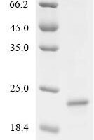 Mouse Solute carrier family 22 member 12 (Slc22a12), partial Recombinant Protein - BioCrest Sci