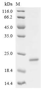 Mouse Solute carrier family 22 member 12 (Slc22a12), partial Recombinant Protein, Mus musculus (Mouse), E.coli, C-terminal 6xHis-tagged, 19.7 kDa, purity >≥ 85% as determined by SDS-PAGE.