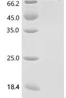 Human Serotransferrin (TF), Biotinylated Recombinant Protein - BioCrest Sci
