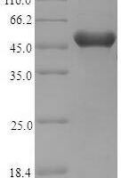 Phleum pratense Pollen allergen Phl p 5a, partial Recombinant Protein - BioCrest Sci