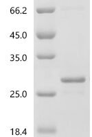 Human Interleukin-10 (IL10) Recombinant Protein, N-His - BioCrest Sci