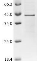 Human Actin, cytoplasmic 1 (ACTB) Recombinant Protein, C-His - BioCrest Sci