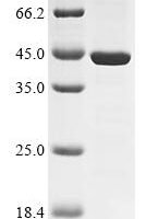 Human Protein SSX1 (SSX1) Recombinant Protein - BioCrest Sci