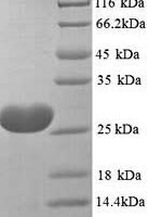 Toxocara canis 26 kDa secreted antigen (TES-26) Recombinant Protein, N-His - BioCrest Sci