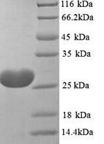 Toxocara canis 26 kDa secreted antigen (TES-26) Recombinant Protein, N-His, Toxocara canis (Canine roundworm), Yeast, N-terminal 6xHis-tagged, 27.9 kDa, purity >≥ 90% as determined by SDS-PAGE.