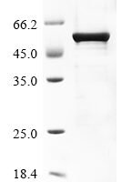 Human HLA class I histocompatibility antigen, alpha chain G (HLA-G) Recombinant Protein, C-10His - BioCrest Sci
