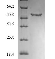 Mouse Monoglyceride lipase (Mgll) Recombinant Protein, N-His-SUMO - BioCrest Sci