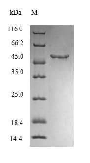 Mouse Monoglyceride lipase (Mgll) Recombinant Protein, N-His-SUMO, Mus musculus (Mouse), E.coli, N-terminal 6xHis-SUMO-tagged, 49.4 kDa, purity >≥ 90% as determined by SDS-PAGE.