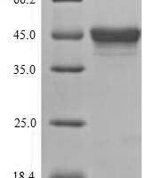 Drosophila melanogaster Stress-activated protein kinase JNK (bsk) Recombinant Protein, C-9xHis - BioCrest Sci