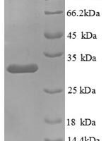 Human Kininogen-1 (KNG1), partial Recombinant Protein - BioCrest Sci