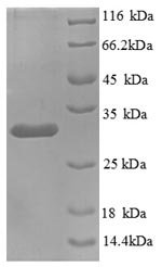 Human Kininogen-1 (KNG1), partial Recombinant Protein, Homo sapiens (Human), E.coli, N-terminal 6xHis-tagged, 31.8 kDa, purity >≥ 90% as determined by SDS-PAGE.