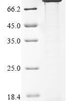Mouse Neural cell adhesion molecule 1 (Ncam1), partial Recombinant Protein, N-His - BioCrest Sci