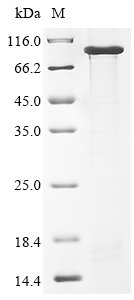 Mouse Neural cell adhesion molecule 1 (Ncam1), partial Recombinant Protein, N-His, Mus musculus (Mouse), E.coli, N-terminal 6xHis-tagged, 80.8 kDa, purity >≥ 85% as determined by SDS-PAGE.