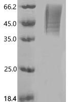 Human MHC class I polypeptide-related sequence A (MICA), partial Recombinant Protein, N-His, aa 24–307, Yeast - BioCrest Sci