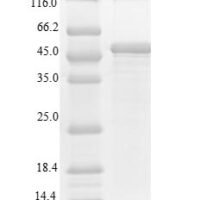 Human Thrombopoietin receptor (MPL), partial Recombinant Protein - BioCrest Sci