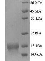 Human ATP synthase subunit delta, mitochondrial (ATP5D) Recombinant Protein, N-His - BioCrest Sci