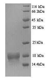 Human ATP synthase subunit delta, mitochondrial (ATP5D) Recombinant Protein, N-His, Homo sapiens (Human), Yeast, N-terminal 6xHis-tagged, 17.0 kDa, purity >≥ 90% as determined by SDS-PAGE.