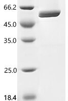 Yeast Lipase 4 (LIP4) Recombinant Protein - BioCrest Sci