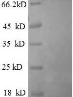 Human Breast carcinoma-amplified sequence 1 (BCAS1) Recombinant Protein, N-His - BioCrest Sci