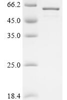 Human Y-box-binding protein 1 (YBX1) Recombinant Protein - BioCrest Sci