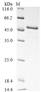 Human NAD-dependent protein deacetylase sirtuin-7 (SIRT7) Recombinant Protein, Homo sapiens (Human), E.coli, N-terminal 10xHis-tagged and C-terminal Myc-tagged, 52.3 kDa, purity >≥ 85% as determined by SDS-PAGE.