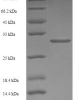 Human Retinoic acid receptor responder protein 2 (RARRES2) Recombinant Protein, N-His-SUMO - BioCrest Sci