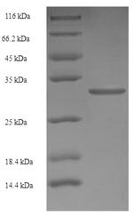 Human Retinoic acid receptor responder protein 2 (RARRES2) Recombinant Protein, N-His-SUMO, Homo sapiens (Human), E.coli, N-terminal 6xHis-SUMO-tagged, 31.9 kDa, purity >≥ 90% as determined by SDS-PAGE.